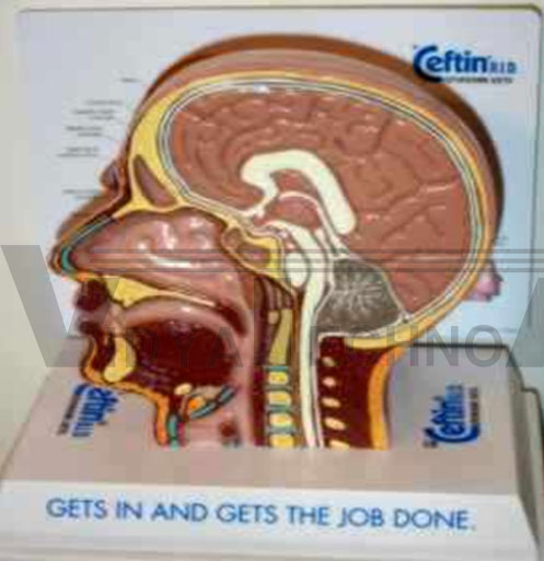 Sinus model